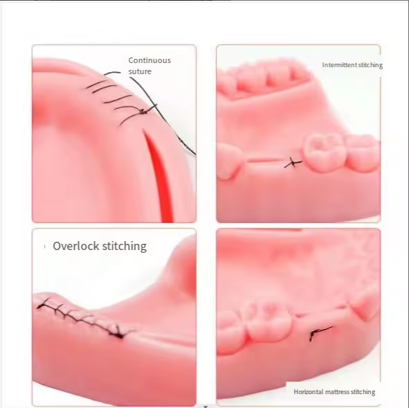 M&oacute;dulo dental kit de treinamento de sutura simulado modelo de sutura oral para treinamento m&eacute;dico dente e almofada de pr&aacute;tica de sutura gengival