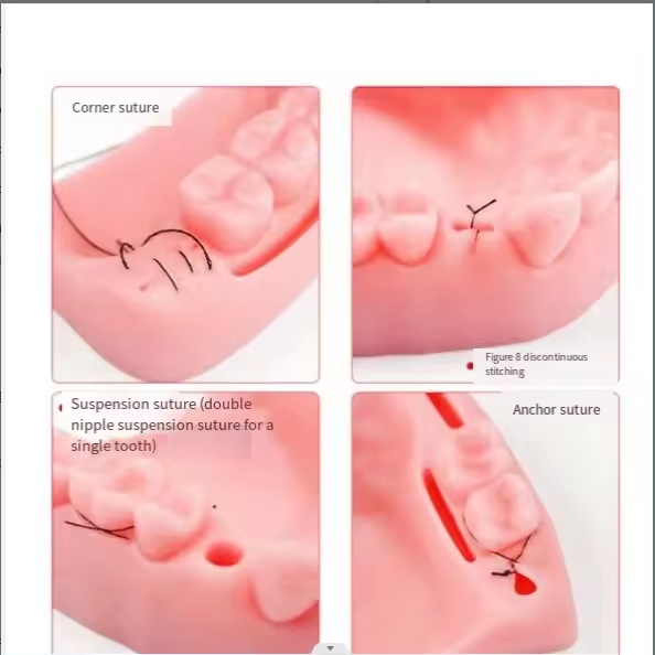 M&oacute;dulo dental kit de treinamento de sutura simulado modelo de sutura oral para treinamento m&eacute;dico dente e almofada de pr&aacute;tica de sutura gengival